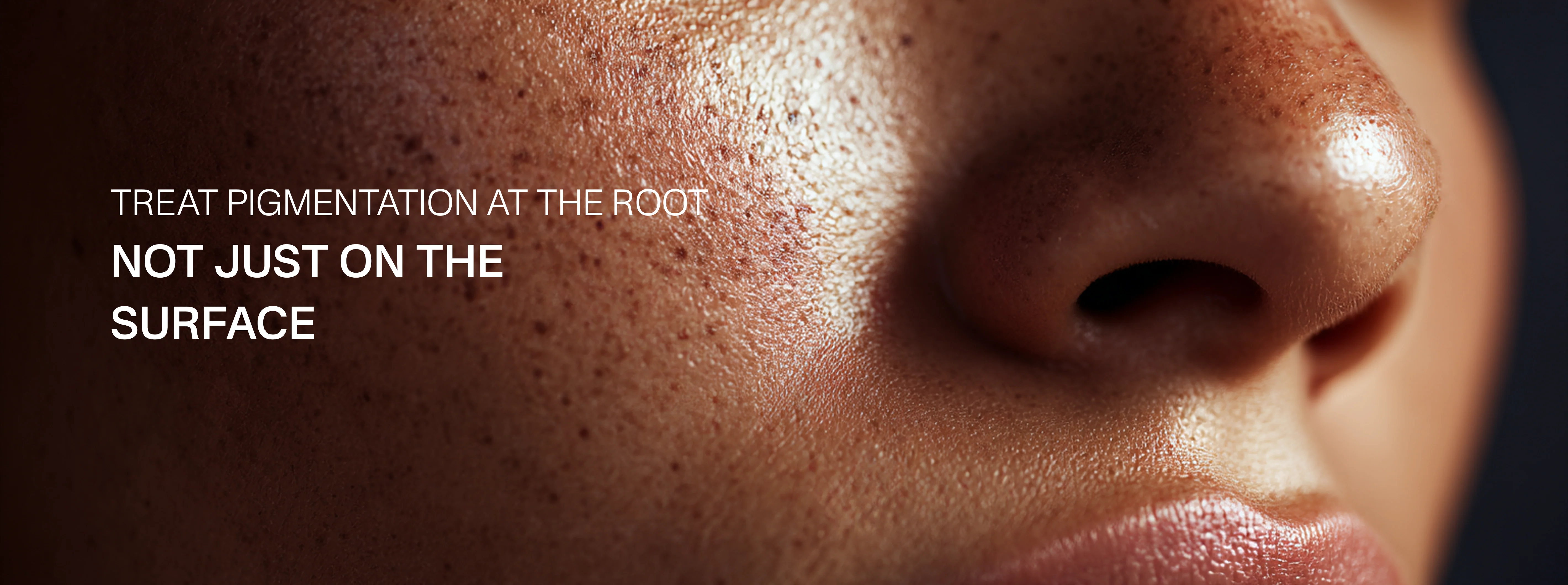 Treat Pigmentation at the Root