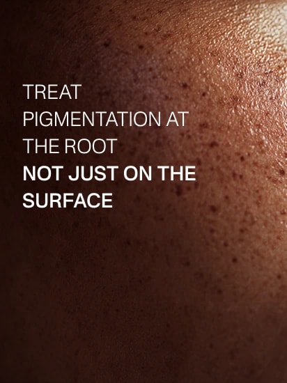 Treat Pigmentation at the Root