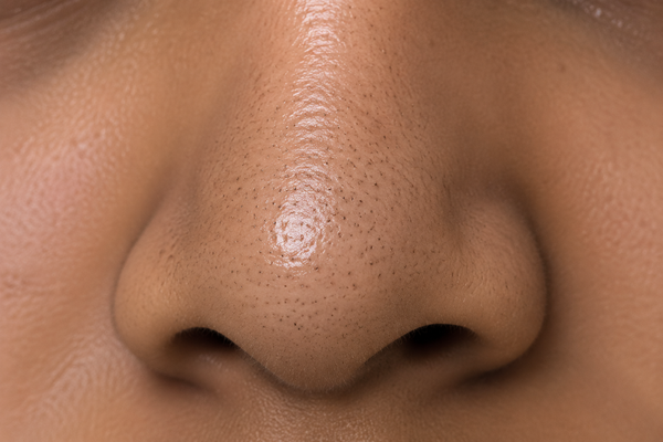 Painful Pimple in Nose? Here’s What It Means
