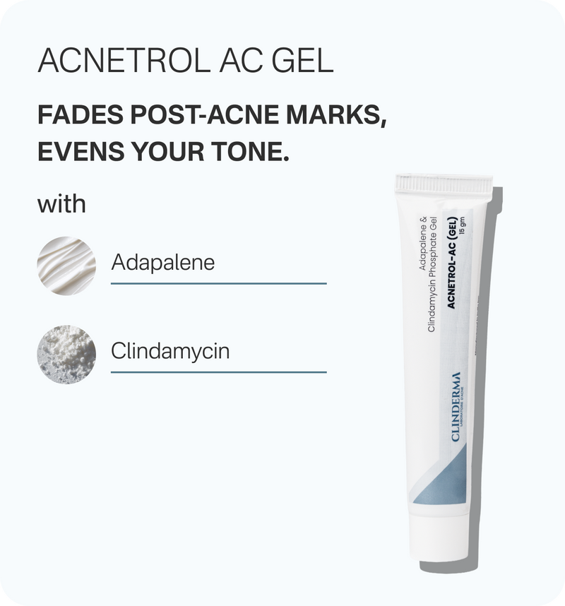 Anti-Acne Kit – Gut + Calm Reset