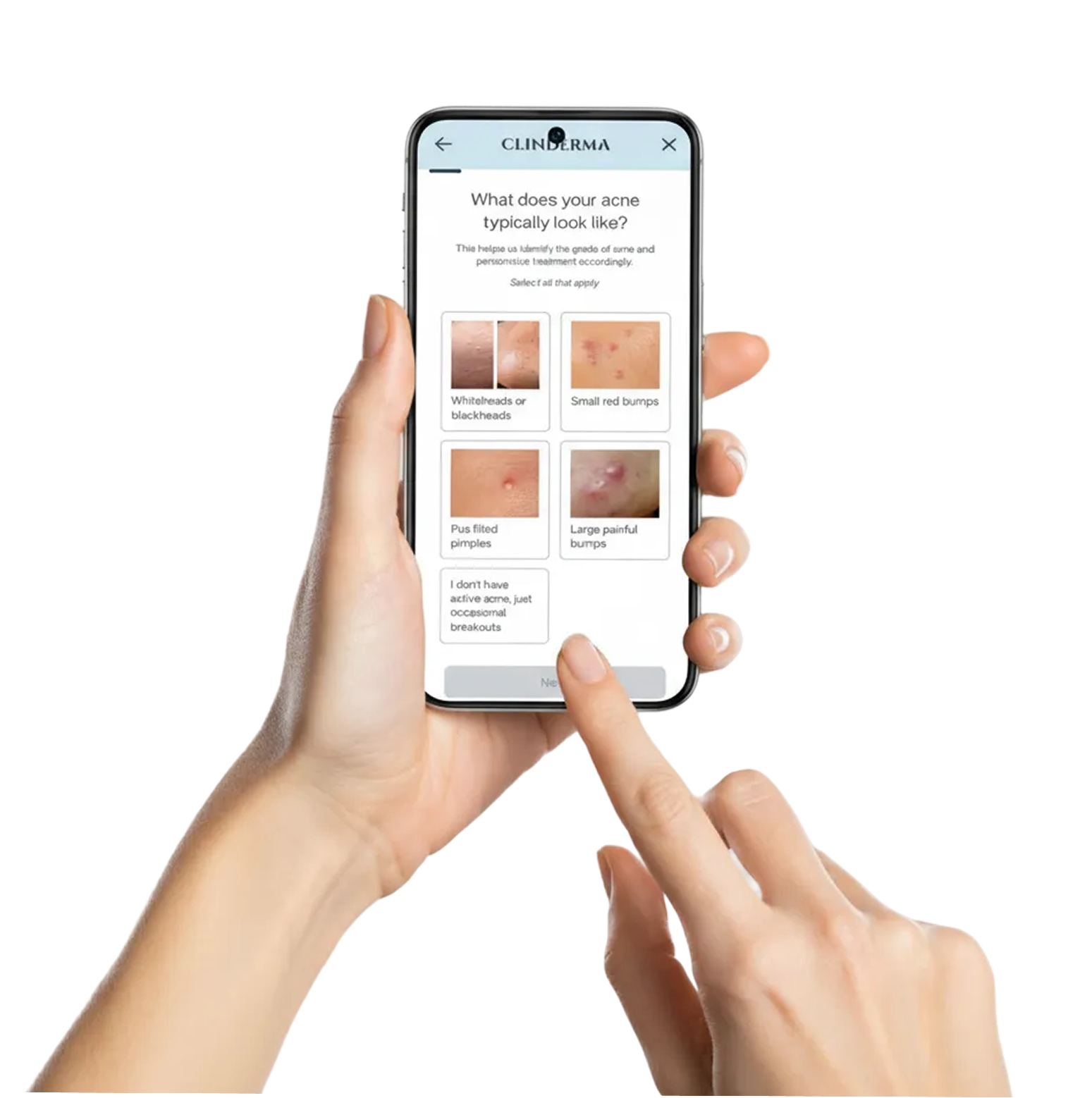 Take a skin test